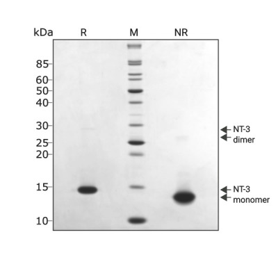 RUO Recombinant Human NT-3 Protein