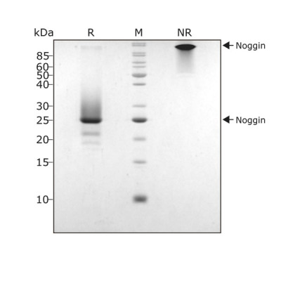 RUO Recombinant Human Noggin Protein