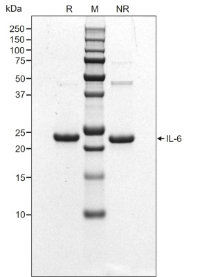 RUO Recombinant Human IL-6 Protein