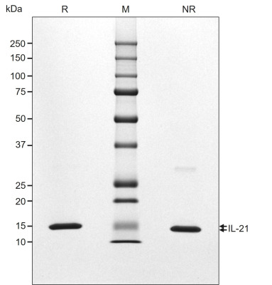 RUO Recombinant Human IL-21 Protein