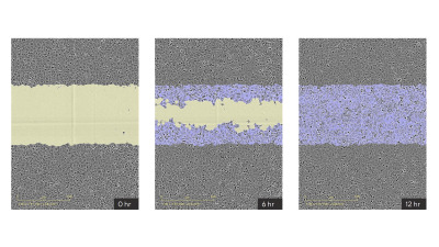 Incucyte® Scratch Wound Analysis Software Module