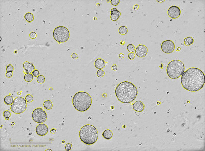 Incucyte® Organoid Analysis Software Module