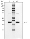 RUO Recombinant Human IL-1 Beta Protein