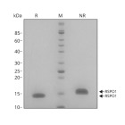 RUO Recombinant Human R-spondin 1 Protein