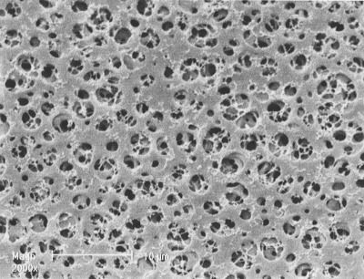 Cellulose Acetate (CA) Membrane Filter