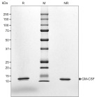 RUO Recombinant Human GM-CSF Protein